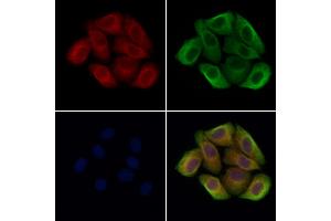 ABIN7094576 and ABIN7098625 staining Hela cells by IF/ICC. (SMPD1 抗体  (C-Term))