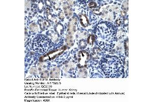 Human kidney (TSFM 抗体  (N-Term))