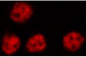 Immunofluorescence (fixed cells) (IF/ICC) image for anti-Nuclear Factor of kappa Light Polypeptide Gene Enhancer in B-Cells 2 (NFKB2) (C-Term) antibody (ABIN6263614)