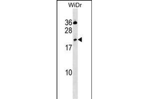 CLEC2D Antibody (Center) (ABIN1537750 and ABIN2850340) western blot analysis in WiDr cell line lysates (35 μg/lane). (CLEC2D 抗体  (AA 109-137))