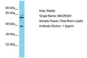 Image no. 1 for anti-MACRO Domain Containing 1 (MACROD1) (AA 83-132) antibody (ABIN6750601) (MACROD1 抗体  (AA 83-132))