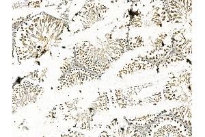 ABIN7094458 and ABIN7098506 at 1/100 staining Rat testis tissue by IHC-P. (CBX7 抗体  (N-Term))