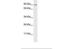Image no. 1 for anti-Zinc Finger Protein 537 (ZNF537) (AA 466-515) antibody (ABIN6735913) (TSHZ3 抗体  (AA 466-515))