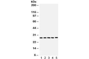 Western blot testing of 1) rat brain, 2) rat testis, 3) NEURO, 4) 293 and 5) SW620 lysate with SF2 antibody. (SRSF1 抗体)
