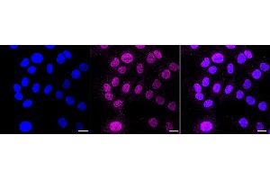Immunocytochemical staining of HT- cells with Cullin 1 antibody (ABIN7798176), 1:1,000). (Recombinant Cullin 1 抗体)