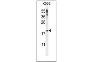 Western blot analysis of IQCJ Antibody (C-term) in K562 cell line lysates (35ug/lane). (IQCJ 抗体  (C-Term))