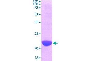 Image no. 1 for Second Mitochondria-Derived Activator of Caspase (DIABLO) (AA 56-239) protein (ABIN5569492) (DIABLO Protein (AA 56-239))