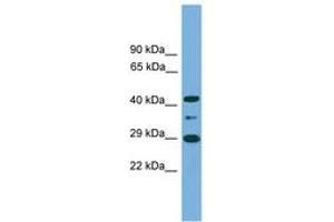 Image no. 1 for anti-Enolase-Phosphatase 1 (ENOPH1) (C-Term) antibody (ABIN6745157) (MASA 抗体  (C-Term))