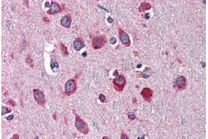 Immunohistochemistry (Formalin-fixed Paraffin-embedded Sections) (IHC (fp)) image for anti-serpin Peptidase Inhibitor, Clade I (neuroserpin), Member 1 (SERPINI1) (AA 17-411) antibody (ABIN790558)