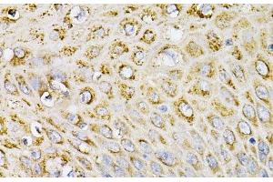 Immunohistochemistry of paraffin-embedded Human esophagus using EFNA1 Polyclonal Antibody at dilution of 1:100 (40x lens). (Ephrin A1 抗体)