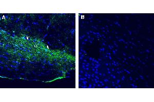 Expression of Opsin 3 in rat optic tract. (OPN3 抗体  (Extracellular))
