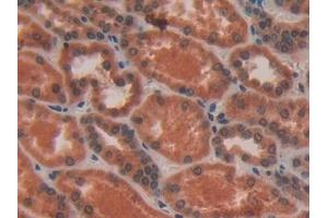 Immunohistochemistry (IHC) image for anti-Vav 3 Oncogene (VAV3) (AA 183-380) antibody (ABIN7437782)