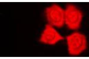 Immunofluorescent analysis of PKN1 staining in HepG2 cells. (PKN1 抗体  (Center))