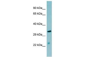 WB Suggested Anti-MASP2 Antibody Titration:  0.