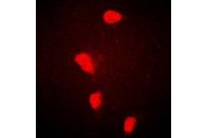 Immunofluorescent analysis of FHL-1 staining in Hela cells. (FHL1 抗体)