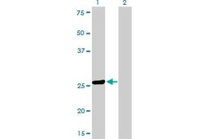 Western Blotting (WB) image for anti-TGFB-Induced Factor Homeobox 2 (TGIF2) (AA 131-236) antibody (ABIN566207)