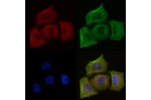 ABIN6259895 and ABIN6273991 staining Hela cells(45 min of heat-shock) by IF/ICC.