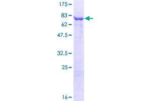 CCT3 Protein (AA 1-544) (GST tag)