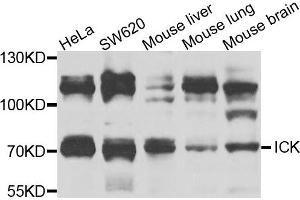 Western blot analysis of extracts of various cells, using ICK antibody. (ICK 抗体)