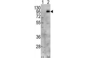 Western Blotting (WB) image for anti-Phosphatidylinositol-4-Phosphate 5-Kinase, Type I, gamma (PIP5K1C) antibody (ABIN3003648) (PIP5K1C 抗体)