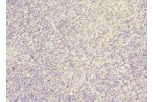 Immunohistochemistry of paraffin-embedded human thymus tissue using ABIN7170393 at dilution of 1:100 (SNX32 抗体  (AA 144-403))