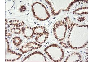 Image no. 2 for anti-Adipocyte Plasma Membrane Associated Protein (APMAP) antibody (ABIN1496662) (APMAP 抗体)