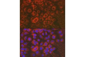Immunofluorescence analysis of Huh7 cells using Sorbitol Dehydrogenase Rabbit pAb (ABIN3022961, ABIN3022962, ABIN3022963, ABIN1513552 and ABIN6219319) at dilution of 1:50 (40x lens). (SORD 抗体  (AA 1-357))