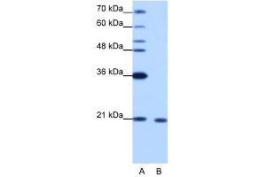 RBM8A antibody used at 1. (RBM8A 抗体  (N-Term))