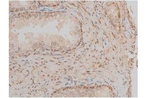 Immunohistochemistry (IHC) image for anti-cAMP Responsive Element Binding Protein 1 (CREB1) (pSer142) antibody (ABIN6254981)