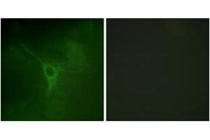 Immunofluorescence analysis of COS7 cells, using GFAP (Phospho-Ser38) Antibody. (GFAP 抗体  (pSer38))