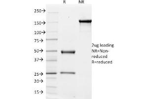 SDS-PAGE Analysis Purified CD51 / Integrin 'V Mouse Monoclonal Antibody (ITGAV/1610). (CD51 抗体)