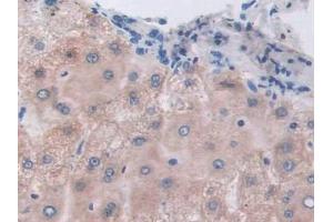 Detection of ETFb in Human Liver Tissue using Polyclonal Antibody to Electron Transfer Flavoprotein Beta Polypeptide (ETFb) (ETFB 抗体  (AA 2-255))