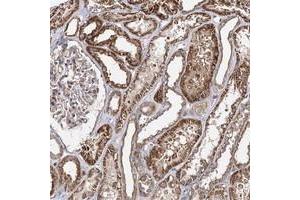Immunohistochemical staining of human kidney with SEC24B polyclonal antibody  shows strong cytoplasmic positivity in cells in tubules at 1:200-1:500 dilution. (SEC24B 抗体)