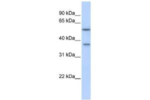 RAB40B antibody used at 1 ug/ml to detect target protein. (RAB40B 抗体  (Middle Region))