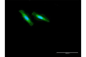 Immunofluorescence of purified MaxPab antibody to GCDH on HeLa cell. (GCDH 抗体  (AA 1-438))
