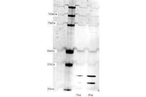 TFAM antibody - N-terminal region  validated by WB using bEND3 cell lysate at lane1:10 ug, lane2:20 ug. (TFAM 抗体  (N-Term))