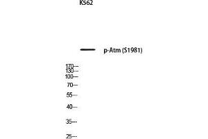 Western Blot (WB) analysis of K562 using p-Atm (S1981) antibody. (ATM 抗体  (pSer1981))