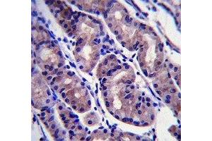 Immunohistochemistry (IHC) image for anti-Forkhead Box A2 (FOXA2) (AA 128-157) antibody (ABIN3030982)