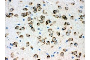 IHC testing of FFPE mouse brain with GRP78 antibody.