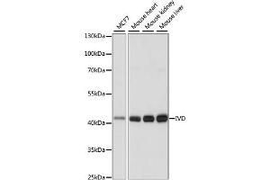 Western blot analysis of extracts of various cell lines, using IVD antibody (ABIN7268031) at 1:1000 dilution. (IVD 抗体  (AA 33-200))