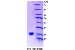 SDS-PAGE analysis of Human S100A9 Protein. (S100A9 蛋白)