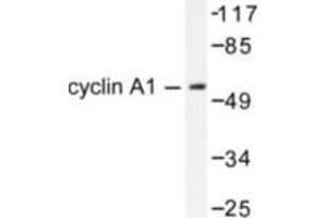 Image no. 2 for anti-Cyclin A1 (CCNA1) antibody (ABIN265378) (Cyclin A1 抗体)