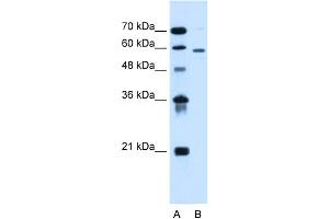 WB Suggested Anti-ALG11 Antibody Titration:  0.