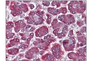 Immunohistochemistry (IHC) image for anti-Protease, serine, 1 (Trypsin 1) (PRSS1) antibody (ABIN614514) (PRSS1 抗体)