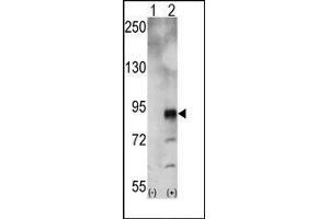 Western blot analysis of EphA5 (arrow) using rabbit polyclonal EphA5 Antibody. (EPH Receptor A5 抗体)