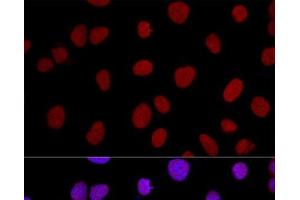 Confocal immunofluorescence analysis of U2OS cells using XRCC5 Polyclonal Antibody at dilution of 1:100. (XRCC5 抗体)