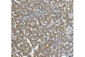 IHC analysis of Cytochrome p450 2C19/CYP2C19 using anti-Cytochrome p450 2C19/CYP2C19 antibody (ABIN7603006).