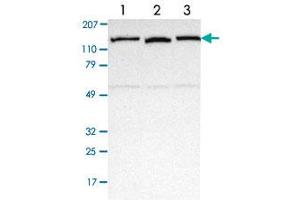 Western blot analysis of Lane 1: Human cell line RT-4 Lane 2: Human cell line EFO-21 Lane 3: Human cell line A-431 with NEK9 polyclonal antibody  at 1:250-1:500 dilution.