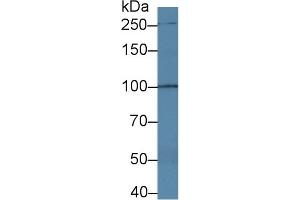 Detection of TRPC6 in Human Serum using Polyclonal Antibody to Transient Receptor Potential Cation Channel Subfamily C, Member 6 (TRPC6)