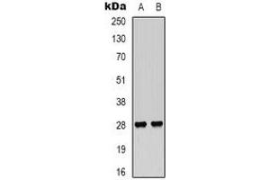 Western blot analysis of VEGI expression in Hela (A), NIH3T3 (B) whole cell lysates. (TNFSF15 抗体)